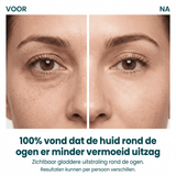 Extra tube — €10 korting