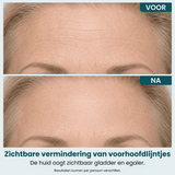 Extra tube — €10 korting